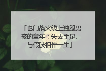 也门战火线上独腿男孩的童年：失去手足、与假肢相伴一生
