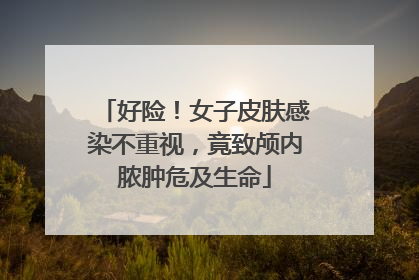 好险！女子皮肤感染不重视，竟致颅内脓肿危及生命
